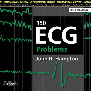 Книги для взрослых: 150 ECG Problems