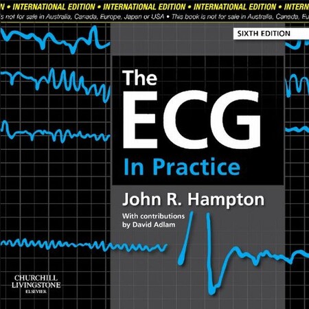 Медицина і здоров`я: The ECG in Practice