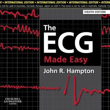 Медицина і здоров`я: The ECG Made Easy (9780702046421)