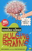 Bulging Brains